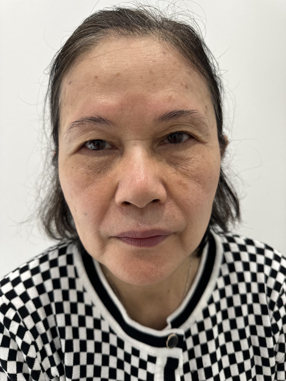 Before microshading eyebrows Grand Prairie TX client